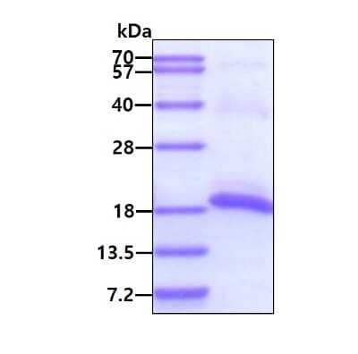 SDS-PAGE: Recombinant Human PPP3R2 His Protein [NBP1-51059]