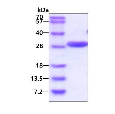 SDS-PAGE: Recombinant Human PRTFDC1 His Protein [NBP1-72340]