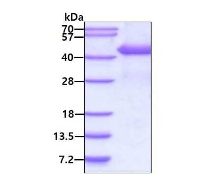 SDS-PAGE: Recombinant Human PSMD13 His Protein [NBP2-51717]