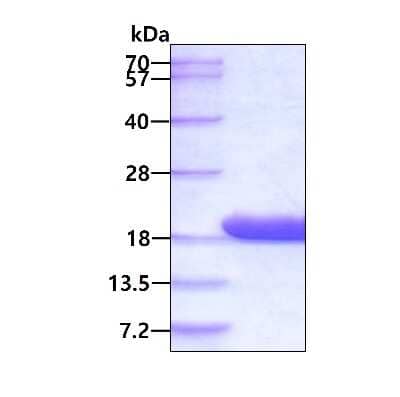 SDS-PAGE: Recombinant Human PTMS His Protein [NBP2-23316]