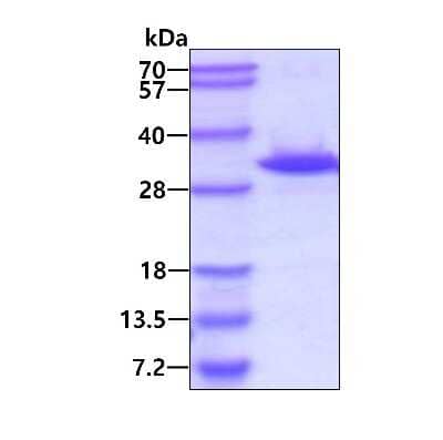 SDS-PAGE: Recombinant Human PYCRL His Protein [NBP2-23389]