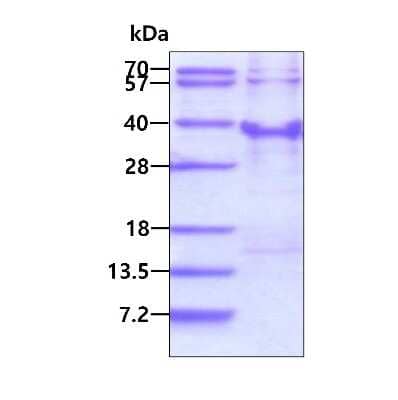 SDS-PAGE: Recombinant Human RFXANK His Protein [NBP2-23404]