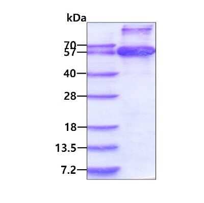 SDS-PAGE: Recombinant Human RNMT His Protein [NBP1-72314]