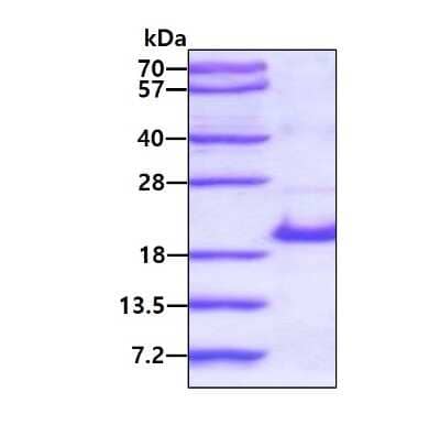 SDS-PAGE: Recombinant Human RPS14 His Protein [NBP1-51002]