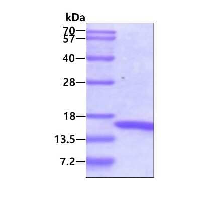 SDS-PAGE: Recombinant Human RXR alpha/NR2B1 Protein [NBC1-18416]