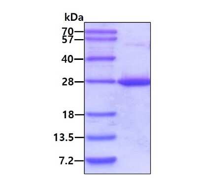 SDS-PAGE: Recombinant Human Rab24 His Protein [NBP1-72488]