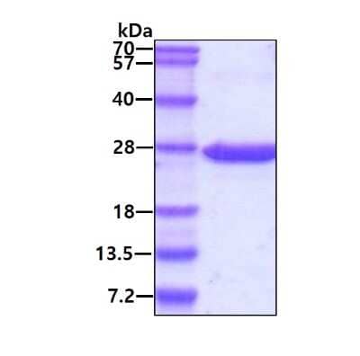 SDS-PAGE: Recombinant Human Rap2A His Protein [NBP1-50939]