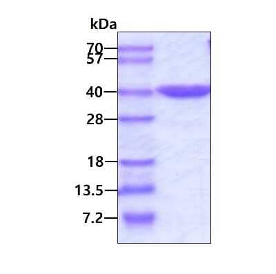 SDS-PAGE: Recombinant Human SEC13 His Protein [NBP1-51076]