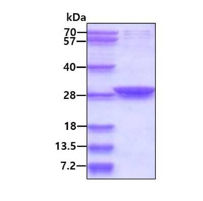 SDS-PAGE: Recombinant Human SIX6 His Protein [NBP2-22810]