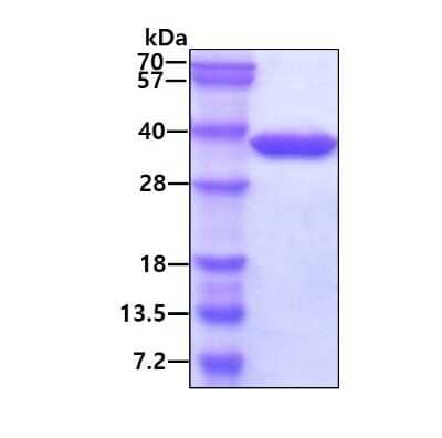 SDS-PAGE: Recombinant Human SRM His Protein [NBP1-50880]