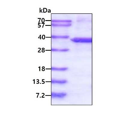 SDS-PAGE: Recombinant Human ST3GAL5 His Protein [NBP2-22824]