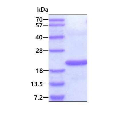 SDS-PAGE: Recombinant Human STAMP2/STEAP4 His Protein [NBP2-51607]