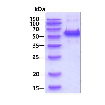 SDS-PAGE: Recombinant Human Soluble Liver/Pancreas Antigen His Protein [NBP1-50890]