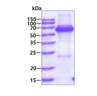 SDS-PAGE: Recombinant Human TCP1 alpha His Protein [NBP1-50854]