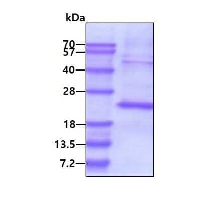 SDS-PAGE: Recombinant Human TSSC3 His Protein [NBP1-44473]