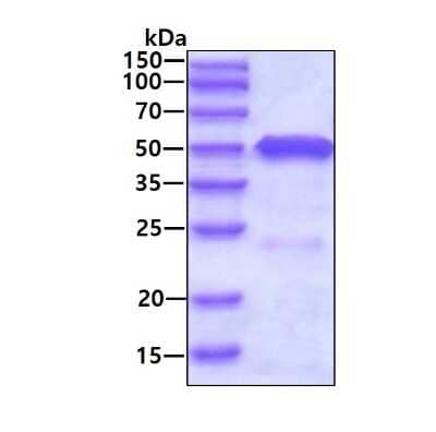 SDS-PAGE: Recombinant Human Testin His Protein [NBP1-48330]