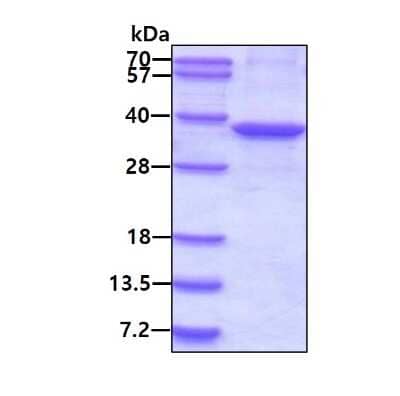 SDS-PAGE: Recombinant Human Torsin A His Protein [NBP2-22872]