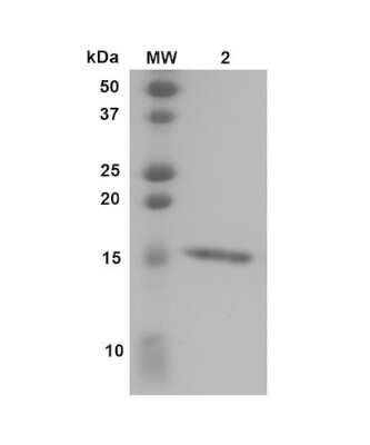 SDS-PAGE: Recombinant Human Transthyretin/Prealbumin L55P Variant, Monomer Protein [NBP3-14786]