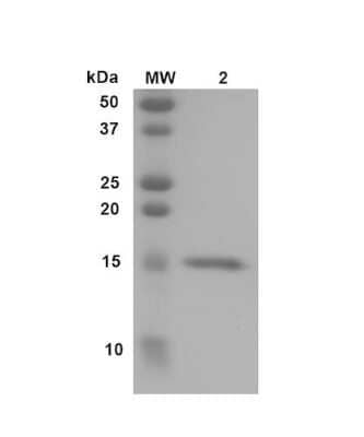 SDS-PAGE: Recombinant Human Transthyretin/Prealbumin Y78F Variant, Monomer Protein [NBP3-14787]