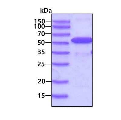 SDS-PAGE: Recombinant Human UAP56 His Protein [NBP1-48590]