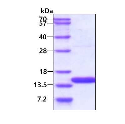 SDS-PAGE: Recombinant Human UBL3 His Protein [NBP1-72327]