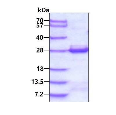 SDS-PAGE: Recombinant Human VBP1 His Protein [NBP2-22943]