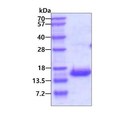 SDS-PAGE: Recombinant Human VOPP1 His Protein [NBP1-72322]