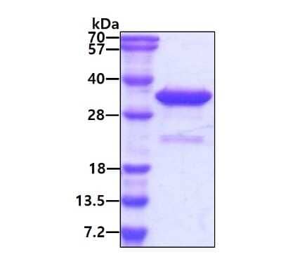 SDS-PAGE: Recombinant Human VPS24 His Protein [NBP1-72349]