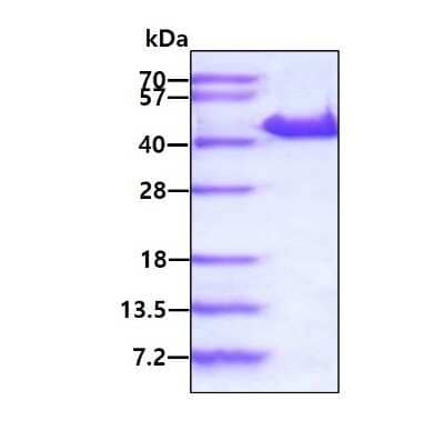 SDS-PAGE: Recombinant Human YOD1 His Protein [NBP2-22955]