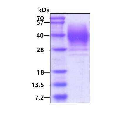 SDS-PAGE: Recombinant Human alpha 1-Acid Glycoprotein His Protein [NBP3-18358]