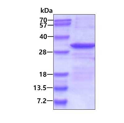 SDS-PAGE: Recombinant Human delta-Sarcoglycan His Protein [NBP2-23452]