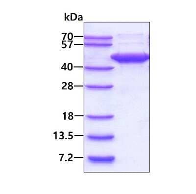 SDS-PAGE: Recombinant Human p38 beta/MAPK11 His Protein [NBP1-72538]