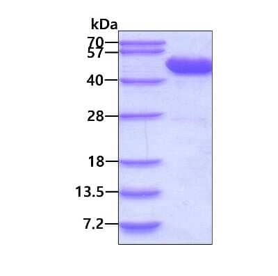 SDS-PAGE: Recombinant Human p38 delta/SAPK4 His Protein [NBP1-72524]