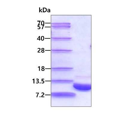 SDS-PAGE: Recombinant Mouse S100A1 His Protein [NBP1-72335]