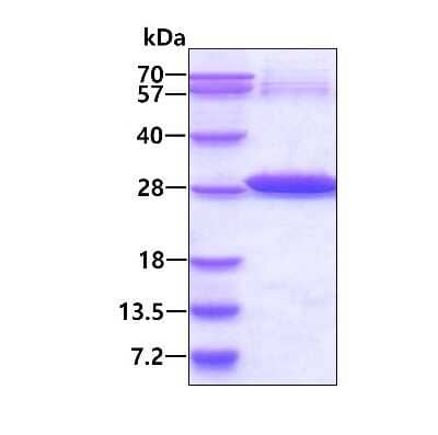 SDS-PAGE: Recombinant GST Epitope Tag His Protein [NBP1-30259]