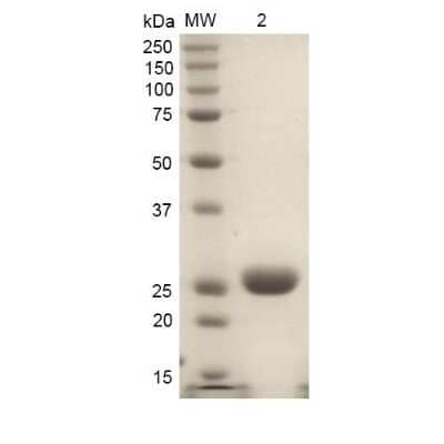 SDS-PAGE: Recombinant Rat HO-1/HMOX1/HSP32 His Protein [NBP3-18328]