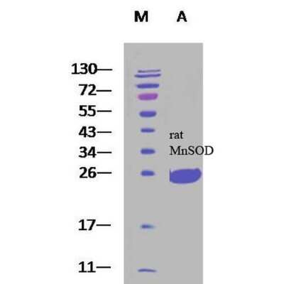 SDS-PAGE: Recombinant Rat SOD2/Mn-SOD His Protein [NBP3-18329]