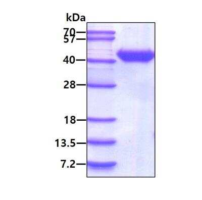 SDS-PAGE: Recombinant Avian Influenza A H7N9 Hemagglutinin (A/Anhui/1-BALF_RG45/2013) His Protein [NBP3-11850]