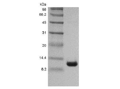 SDS-PAGE: Recombinant Cholera Toxin Beta Protein [NBP2-61449]