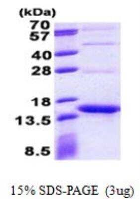 SDS-PAGE: Recombinant Streptavidin His Protein [NBP2-22641]