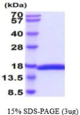SDS-PAGE: Recombinant Canine IL-2 His Protein [NBP2-59565]
