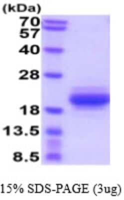 SDS-PAGE: Recombinant Canine IL-31 His Protein [NBP2-59591]