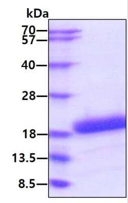 SDS-PAGE: Recombinant Canine IL-31 Protein [NBP2-77493]