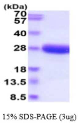 SDS-PAGE: Recombinant Canine IL-6 His Protein [NBP2-59564]