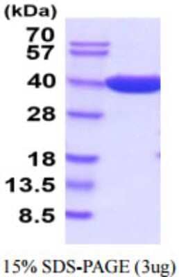 SDS-PAGE: Recombinant E. coli beta-lactamase His Protein [NBP2-59641]