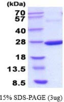 SDS-PAGE: Recombinant E. coli C9orf103 His Protein [NBP2-52239]