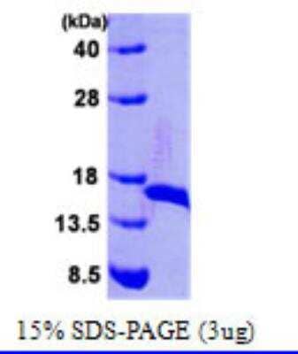 SDS-PAGE: Recombinant E. coli DsbE Protein [NBC1-21275]