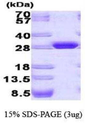 SDS-PAGE: Recombinant GFP Protein [NBC1-22949]