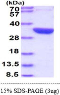 SDS-PAGE: Recombinant E. coli Glutaminase His Protein [NBP1-72301]