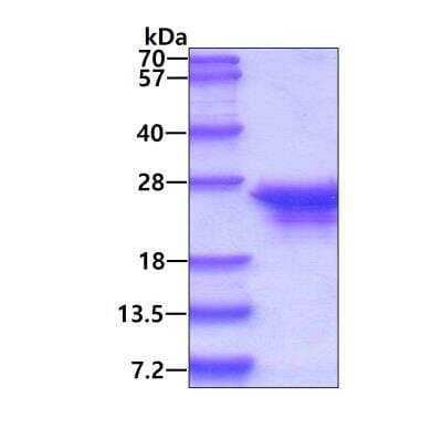 SDS-PAGE: Recombinant E. coli GrpE Protein [NBC1-18370]